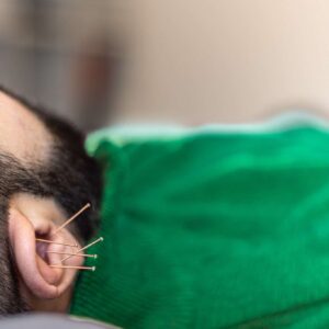 Öronakupunktur i Jönkoping