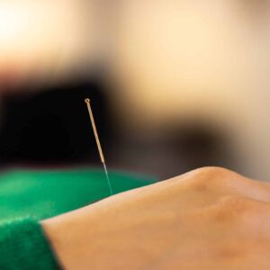 akupunktur i Jönkoping